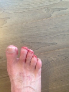 Bloody Toes